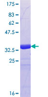ab158207 on a 12.5% SDS-PAGE stained with Coomassie Blue.