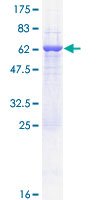 ab158208 on a 12.5% SDS-PAGE stained with Coomassie Blue.
