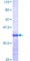 ab158209 on a 12.5% SDS-PAGE stained with Coomassie Blue.