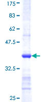 ab162535 on a 12.5% SDS-PAGE stained with Coomassie Blue.