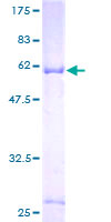 ab163222 on a 12.5% SDS-PAGE stained with Coomassie Blue.