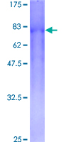 ab163095 on a 12.5% SDS-PAGE stained with Coomassie Blue.