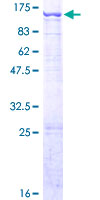 ab162753 on a 12.5% SDS-PAGE stained with Coomassie Blue.