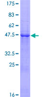 ab158214 on a 12.5% SDS-PAGE stained with Coomassie Blue.