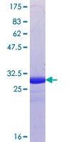 ab165032 on a 12.5% SDS-PAGE stained with Coomassie Blue.