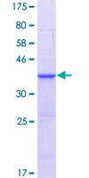 ab158574 on a 12.5% SDS-PAGE stained with Coomassie Blue.