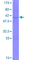 ab158216 on a 12.5% SDS-PAGE stained with Coomassie Blue.