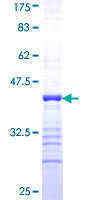 ab160079 on a 12.5% SDS-PAGE stained with Coomassie Blue.