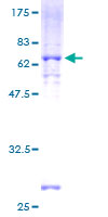 ab165179 on a 12.5% SDS-PAGE stained with Coomassie Blue.