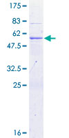 ab164259 on a 12.5% SDS-PAGE stained with Coomassie Blue.