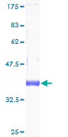 ab158224 on a 12.5% SDS-PAGE stained with Coomassie Blue.