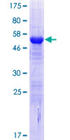 ab163059 on a 12.5% SDS-PAGE stained with Coomassie Blue.