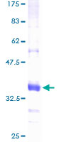 ab158225 on a 12.5% SDS-PAGE stained with Coomassie Blue.