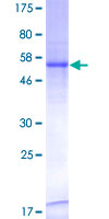 ab160819 on a 12.5% SDS-PAGE stained with Coomassie Blue.