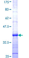 ab160820 on a 12.5% SDS-PAGE stained with Coomassie Blue.