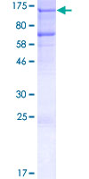 ab152651 on a 12.5% SDS-PAGE stained with Coomassie Blue.