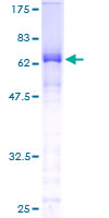 ab162228 on a 12.5% SDS-PAGE stained with Coomassie Blue.