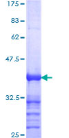 ab162225 on a 12.5% SDS-PAGE stained with Coomassie Blue.