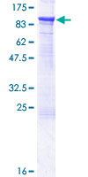 ab160164 on a 12.5% SDS-PAGE stained with Coomassie Blue.