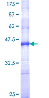 ab160165 on a 12.5% SDS-PAGE stained with Coomassie Blue.