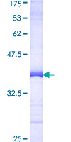 ab153418 on a 12.5% SDS-PAGE stained with Coomassie Blue.
