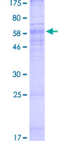 ab158228 on a 12.5% SDS-PAGE stained with Coomassie Blue.