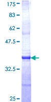 ab158229 on a 12.5% SDS-PAGE stained with Coomassie Blue.