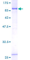 ab163378 on a 12.5% SDS-PAGE stained with Coomassie Blue.