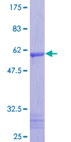ab165053 on a 12.5% SDS-PAGE stained with Coomassie Blue.