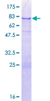 ab153111 on a 12.5% SDS-PAGE stained with Coomassie Blue.
