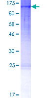 ab160036 on a 12.5% SDS-PAGE stained with Coomassie Blue.