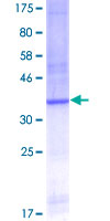 ab160037 on a 12.5% SDS-PAGE stained with Coomassie Blue.