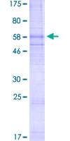 ab159898 on a 12.5% SDS-PAGE stained with Coomassie Blue.