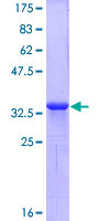 ab159899 on a 12.5% SDS-PAGE stained with Coomassie Blue.