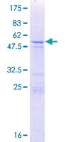 ab162919 on a 12.5% SDS-PAGE stained with Coomassie Blue.