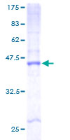ab161278 on a 12.5% SDS-PAGE stained with Coomassie Blue.