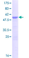 ab165220 on a 12.5% SDS-PAGE stained with Coomassie Blue.