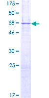 ab162644 on a 12.5% SDS-PAGE stained with Coomassie Blue.