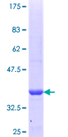 ab162645 on a 12.5% SDS-PAGE stained with Coomassie Blue.