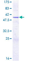 ab162637 on a 12.5% SDS-PAGE stained with Coomassie Blue.