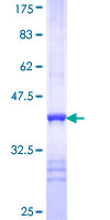 ab162440 on a 12.5% SDS-PAGE stained with Coomassie Blue.
