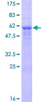 ab158041 on a 12.5% SDS-PAGE stained with Coomassie Blue.