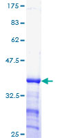 ab158043 on a 12.5% SDS-PAGE stained with Coomassie Blue.