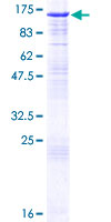 ab158044 on a 12.5% SDS-PAGE stained with Coomassie Blue.