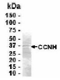 Analysis of CCNH Recombinant Protein, the purified recombinant protein shows a band at 37.1 kDa (Calculated). Commassie blue stained gel.