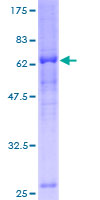 ab162804 on a 12.5% SDS-PAGE stained with Coomassie Blue.