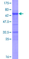 ab165923 on a 12.5% SDS-PAGE stained with Coomassie Blue.
