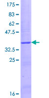 ab153207 on a 12.5% SDS-PAGE stained with Coomassie Blue.