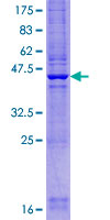 ab162347 on a 12.5% SDS-PAGE stained with Coomassie Blue.