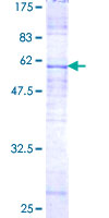 ab158242 on a 12.5% SDS-PAGE stained with Coomassie Blue.